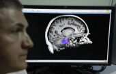 روسيا...علماء يبتكرون حاملا اصطناعيا للعقل البشري الطبيعي | موقع سوا 