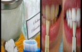  طريقة جديدة لتبييض الأسنان في 3 دقائق فقط! | موقع سوا 