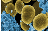 بكتيريا تقتل شابا في مسبح | موقع سوا 