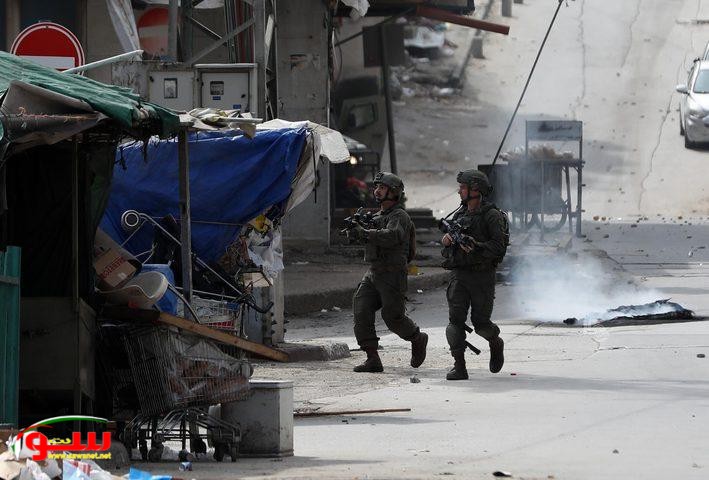 3 اصابات برصاص الاحتلال في حارة الياسمينة بمدينة نابلس