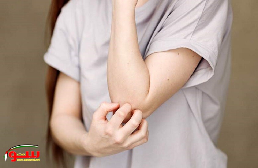 أمراض وعادات مرتبطة بجفاف الجلد