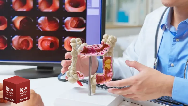 أدوية شائعة للقولون العصبي تحت المجهر